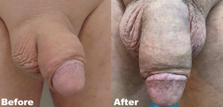 After Agree Image