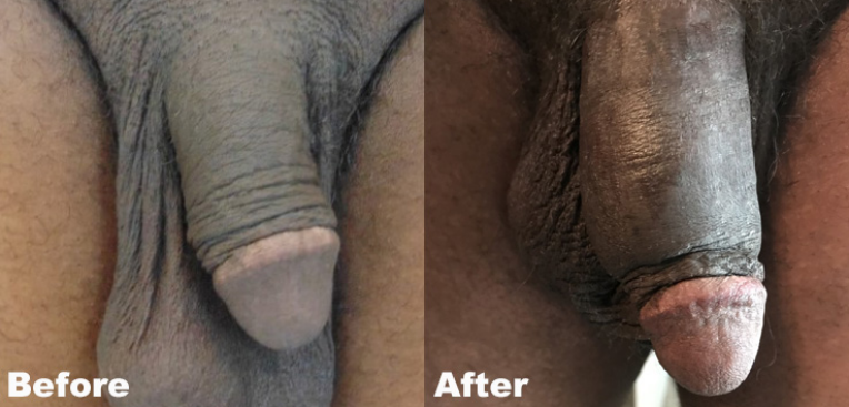 After Agree Image